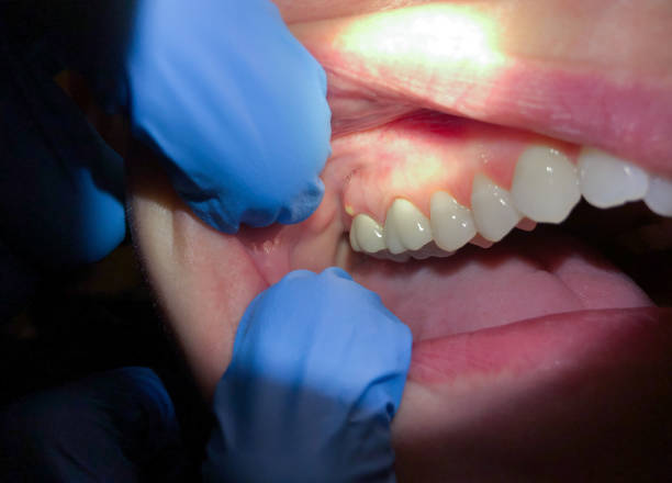 Best Pediatric Emergency Dentist in Amelia, OH
